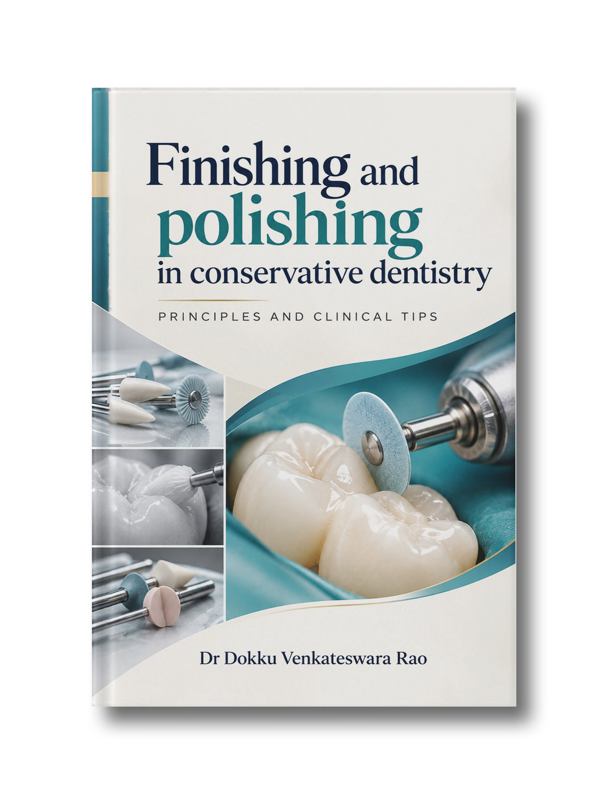 Finishing and polishing in conservative dentistry: principles and clinical tips